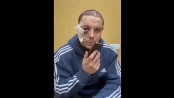 Jeden ze zajatých ruských vojáků na Ukrajině, zdroj: Повернись живим