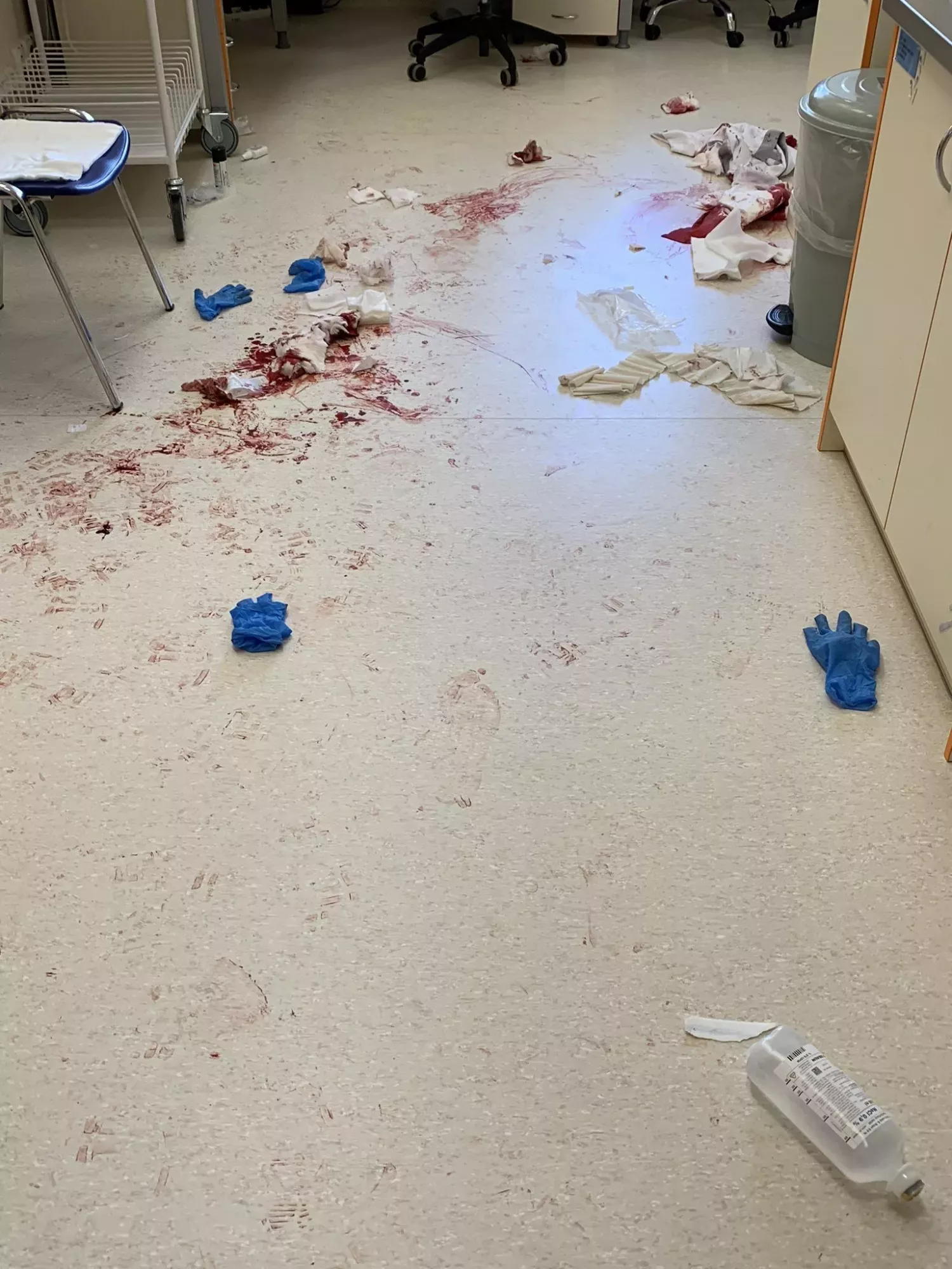 Muž s mačetou zaútočil v nemocnici v Českých Budějovicích. (16.6.2023)
