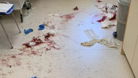 Muž s mačetou zaútočil v nemocnici v Českých Budějovicích. (16.6.2023)